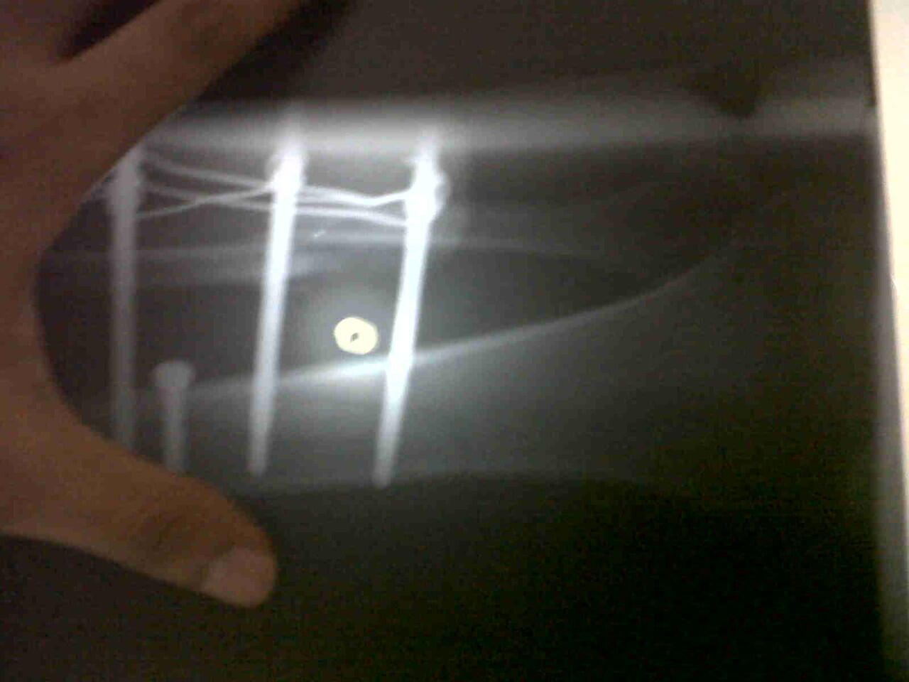 Ts korban tabrak lari ( ASLI ) ijin curhat ya momon mimin