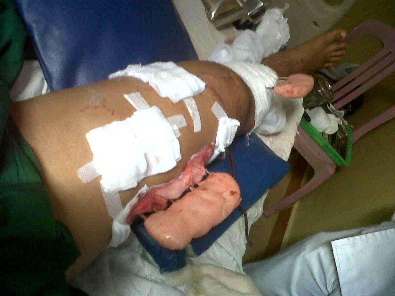 Ts korban tabrak lari ( ASLI ) ijin curhat ya momon mimin
