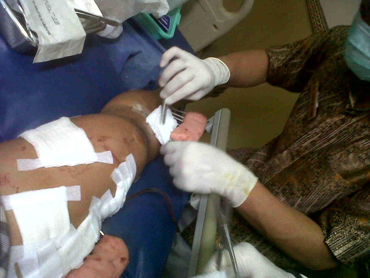 Ts korban tabrak lari ( ASLI ) ijin curhat ya momon mimin