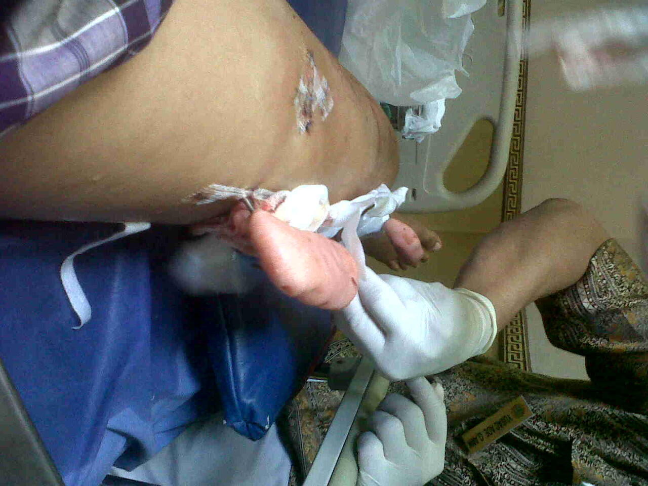 Ts korban tabrak lari ( ASLI ) ijin curhat ya momon mimin