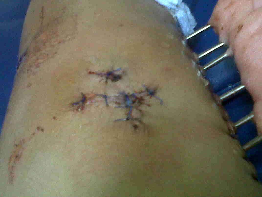 Ts korban tabrak lari ( ASLI ) ijin curhat ya momon mimin