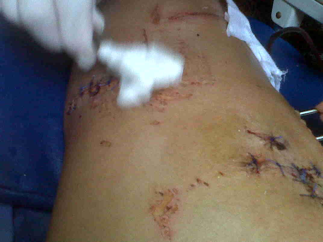 Ts korban tabrak lari ( ASLI ) ijin curhat ya momon mimin
