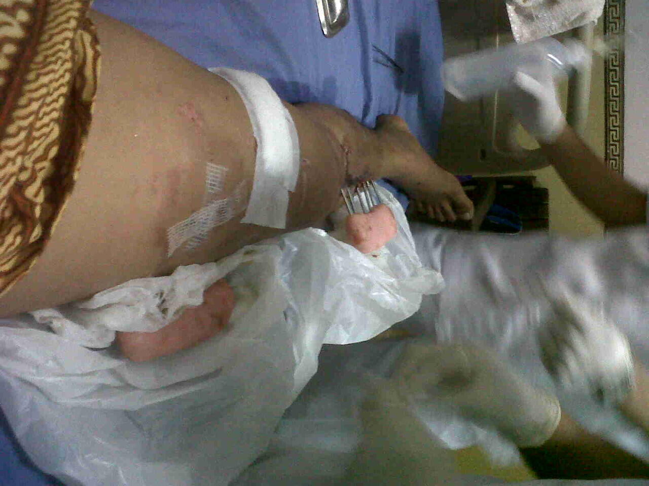 Ts korban tabrak lari ( ASLI ) ijin curhat ya momon mimin