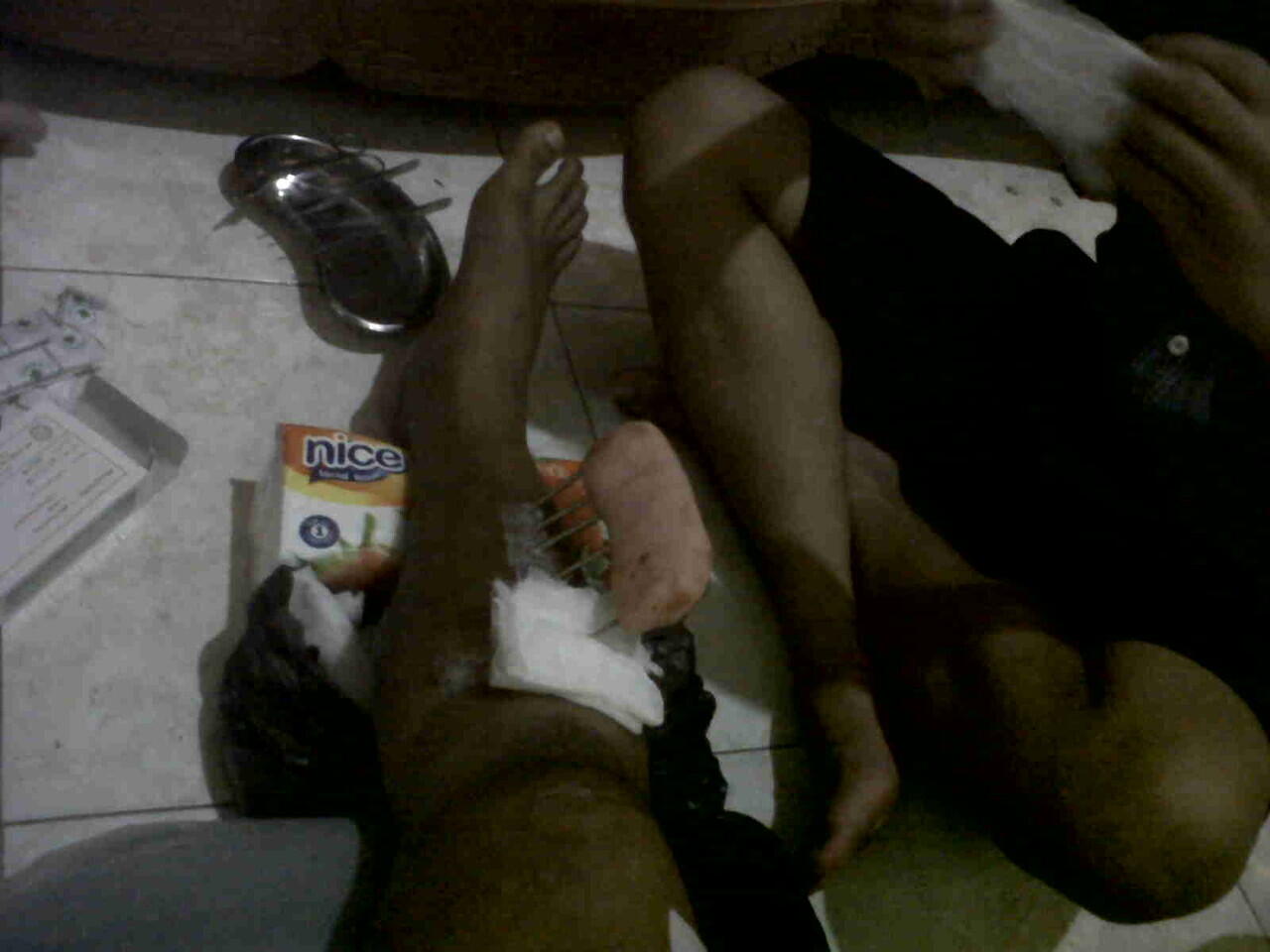 Ts korban tabrak lari ( ASLI ) ijin curhat ya momon mimin