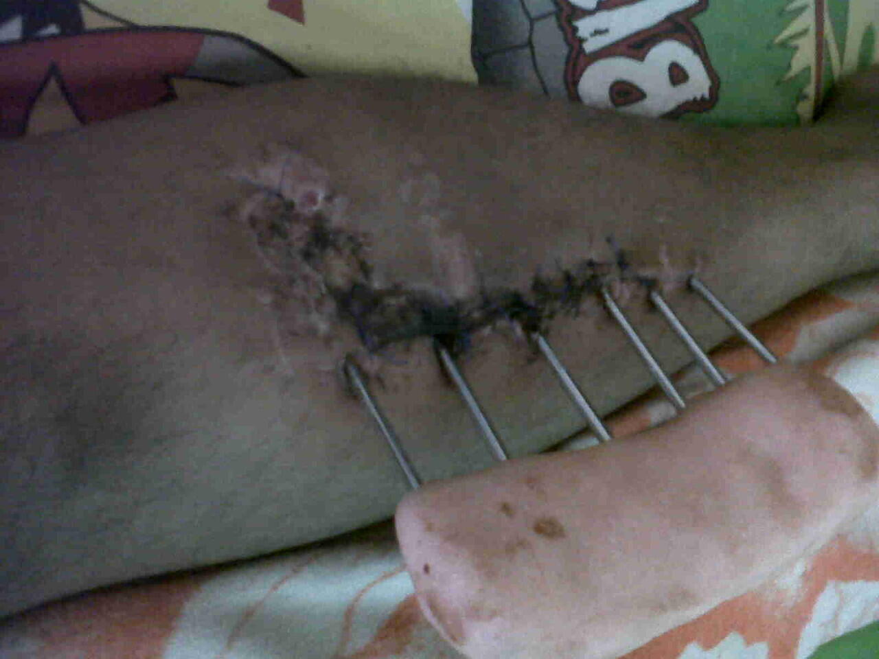Ts korban tabrak lari ( ASLI ) ijin curhat ya momon mimin