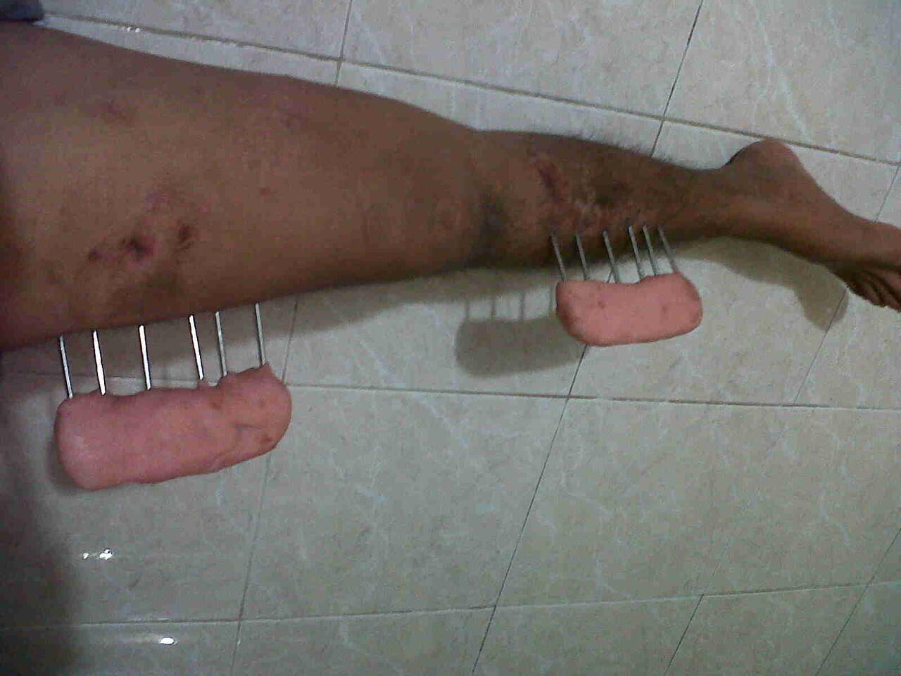 Ts korban tabrak lari ( ASLI ) ijin curhat ya momon mimin