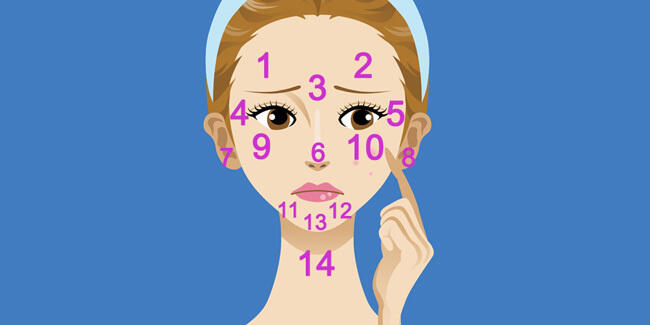 POSISI JERAWAT DIWAJAH JADI SINYAL MASALAH KESEHATAN