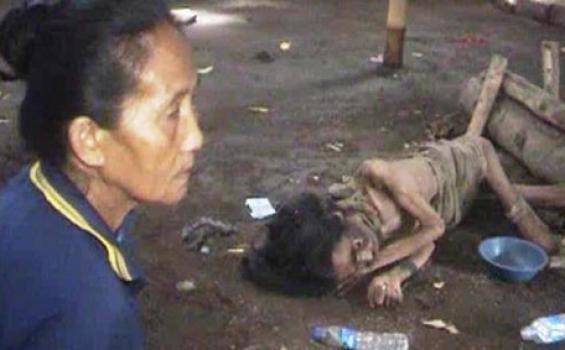 &#91;Foto&#93; Hukum Pasung Indonesia (saatnya dihapuskan)