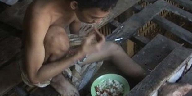 &#91;Foto&#93; Hukum Pasung Indonesia (saatnya dihapuskan)