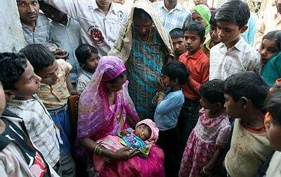 Bayi Berkepala 2 dan Bermata 4 di India