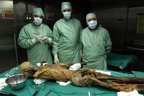 WOW!, 5 Fakta Mengejutkan Tentang Ötzi Si Manusia Es