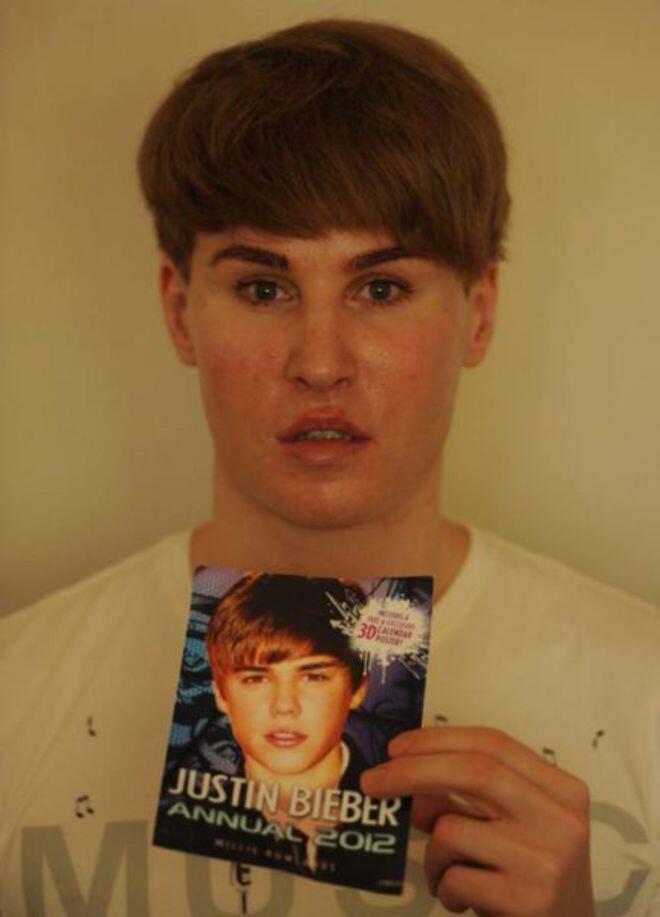 Demi Mirip Justin Bieber, Fans Ini Rela Operasi Plastik!