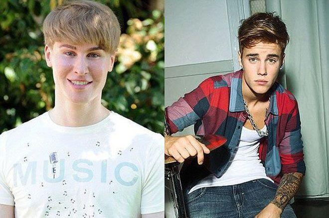 Demi Mirip Justin Bieber, Fans Ini Rela Operasi Plastik!