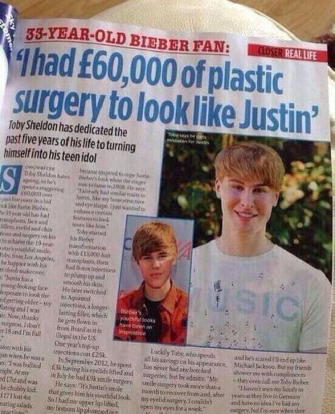 Demi Mirip Justin Bieber, Fans Ini Rela Operasi Plastik!