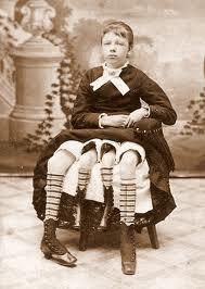 Josephine Myrtle Corbin, manusia berkaki 4