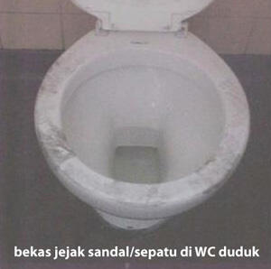 BERBAHAYA: Jangan Pernah Jongkok Di Atas WC Duduk Gan!!