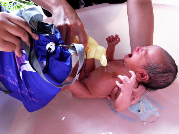 LOTUS BIRTH - SHARE