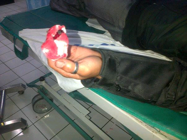 WASPADA SAMA MOTOR ANDA