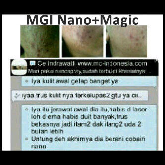 Peluang emas & bisnis NANO MAGIC MCI (BOOMING)