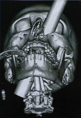 Hasil Foto X-Ray Paling Mengerikan di Dunia