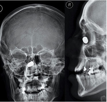 Hasil Foto X-Ray Paling Mengerikan di Dunia
