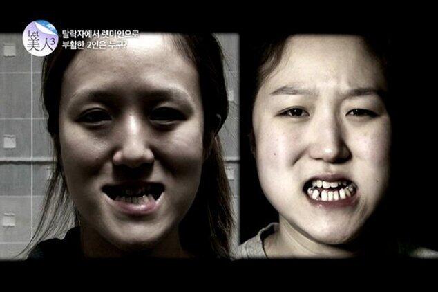  Potret Perubahan si Kembar asal Korea yang Kini Jadi Putri Cantik Jelita