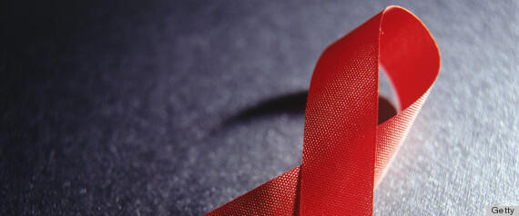 Salah Kaprah Membedakan HIV dengan AIDS