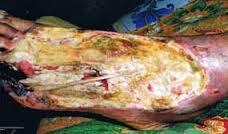 Bahaya tidur pagi !!!