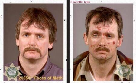 (pict) wajah para pemakai narkoba sebelum dan sesudah kecanduan. Parah!