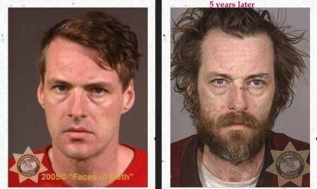 (pict) wajah para pemakai narkoba sebelum dan sesudah kecanduan. Parah!