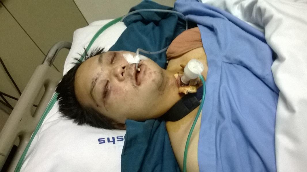 &#91;UPDATE&#93; Mohon Bantu Donasi Utk Kakaknya Teman Ane Kecelakaan di Tol Cipularang