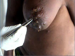 Monster dalam tubuh manusia