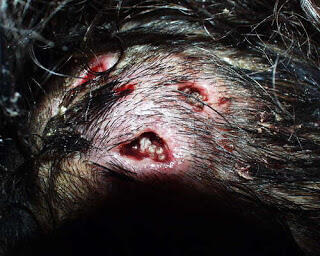 Monster dalam tubuh manusia