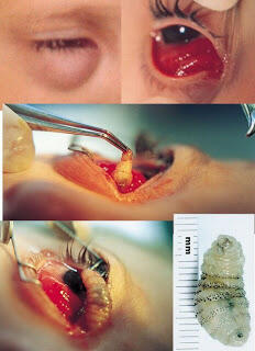 Monster dalam tubuh manusia