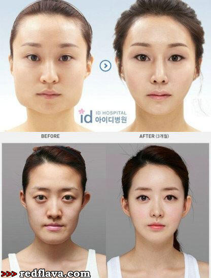 Kumpulan Foto Before - After orang Korea gan (gile banget perbedaannya)