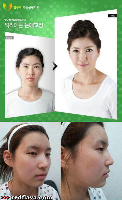 Kumpulan Foto Before - After orang Korea gan (gile banget perbedaannya)