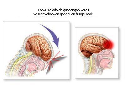 Semoga Buta dan Tuli