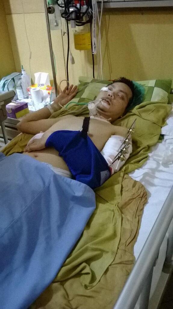 &#91;UPDATE&#93; Mohon Bantu Donasi Utk Kakaknya Teman Ane Kecelakaan di Tol Cipularang