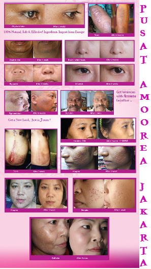 SABUN AMOOREA ALL IN ONE