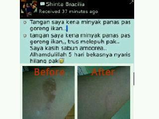 SABUN AMOOREA ALL IN ONE