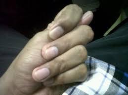 fenomena jempol di gepit jari telunjuk ama jari tengah