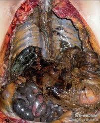 Buat Anak Sekolah yang tak asing dengan ROKOK!