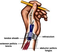 Mengenal Syndrome De Quervain (Yang hoby sport masuk!!)