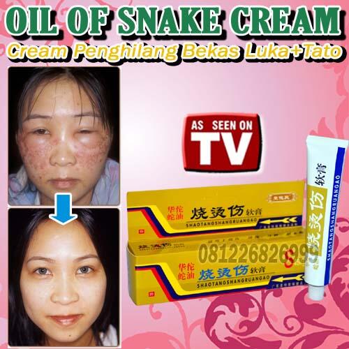 OIL OF SNAKE CREAM (Penghilang Bekas Luka Dan Tato) Pin BB 2A6D5B30