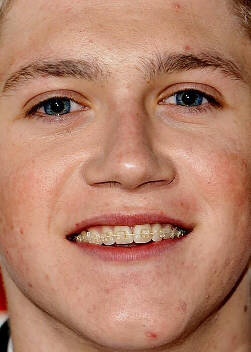 Foto Foto Artis Idola Agan Kalau Di Close Up (NGAKAK GAN)