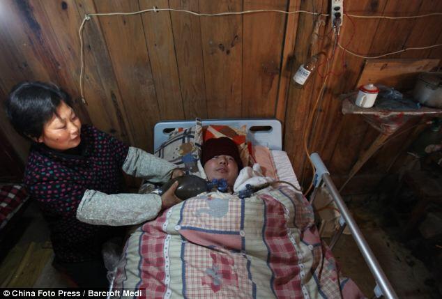 &#91;Menyedihkan&#93;Berjuang Hidup Dengan Ventilator Buatan
