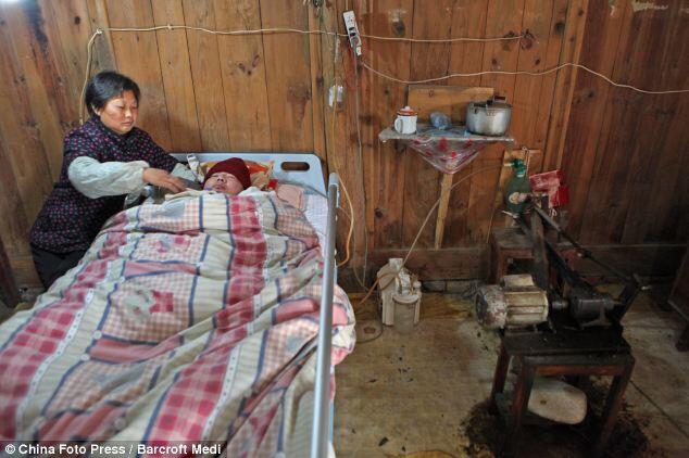 &#91;Menyedihkan&#93;Berjuang Hidup Dengan Ventilator Buatan