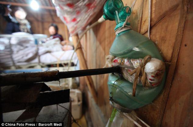 &#91;Menyedihkan&#93;Berjuang Hidup Dengan Ventilator Buatan