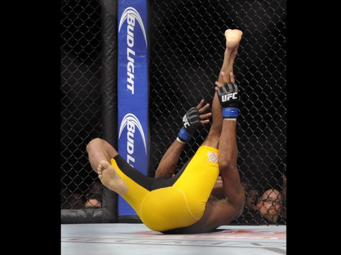 Anderson Silva Petarung UFC Patah Kaki