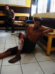 DORRR....KAKI DI TEMBAK..!!!